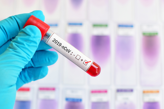 FDA authorises combination flu-covid test for home use
